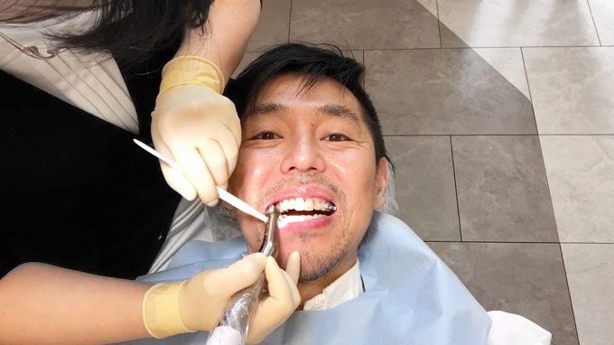 噛み合わせ 前歯が当たらない 原因と改善方法 歯列矯正体験談
