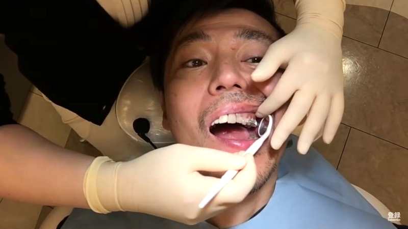 歯列矯正中に虫歯が見つかった時の様子