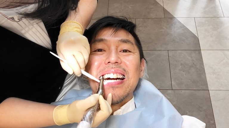 前歯が当たらない噛み合わせを治した、矯正以外の驚きの方法