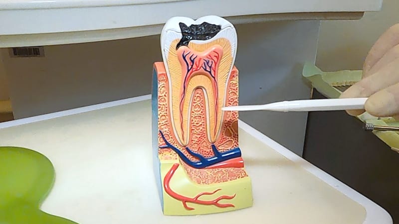 歯の断面図の模型